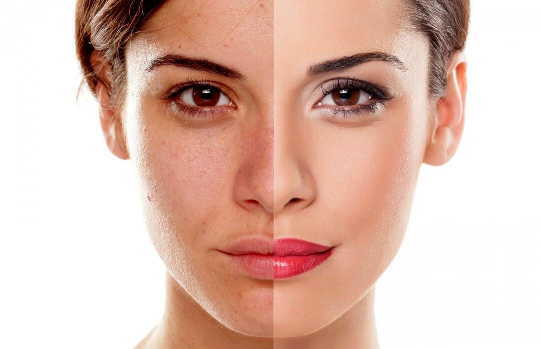 Como evitamos que a pele pareça cansada? Como reduzir o aspecto cansado da pele?