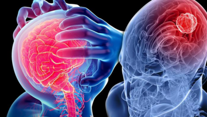 O que é degeneração do cerebelo (medula espinhal)? Quais são os sintomas do cerebelo (medula espinhal)?