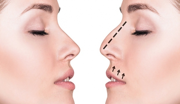 Coisas a considerar na estética do nariz