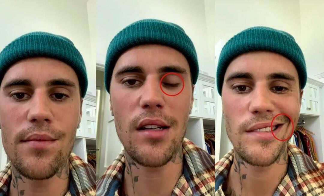 Justin Bieber teve uma paralisia facial! A famosa estrela não pode fazer uma turnê mundial mais uma vez