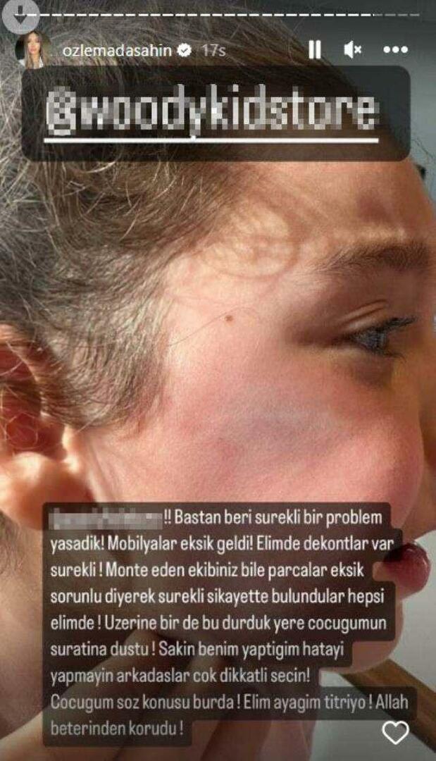 A porta do guarda-roupa caiu no rosto da filha de Berkay Şahin