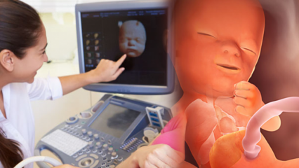 Qual órgão se desenvolve primeiro em bebês? Desenvolvimento do bebê semana a semana