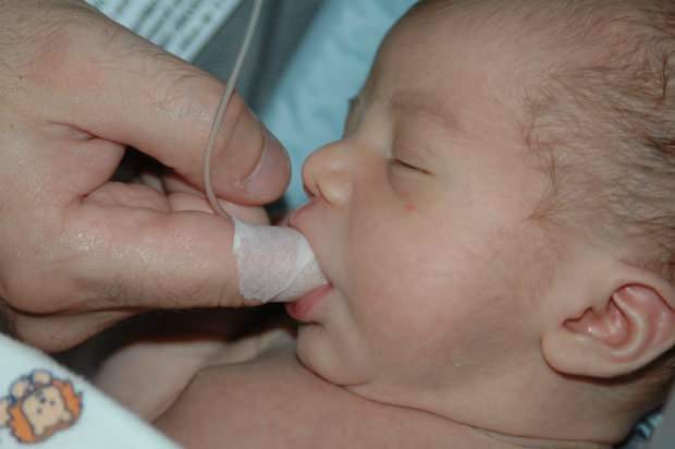 Qual é o método de alimentação dos dedos? Como alimentar o bebê com uma seringa?