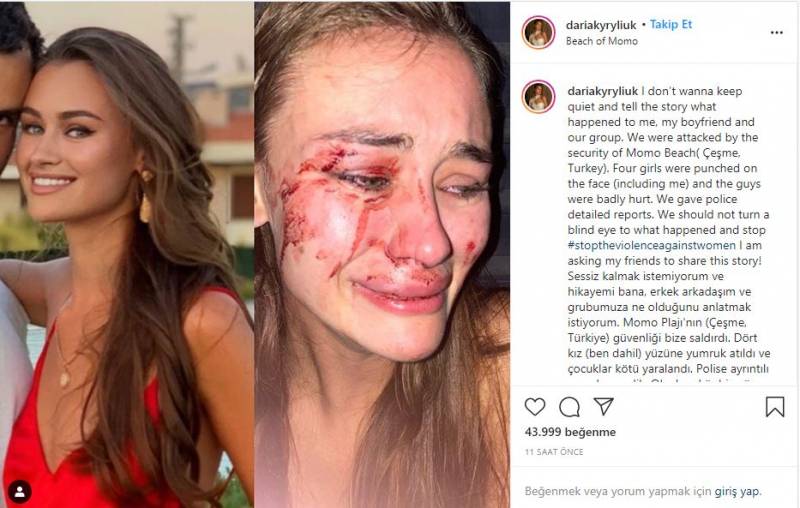 Daria Kyryliuk, a modelo que foi espancada em İzmir Çeşme, foi pega pelo coronavírus!