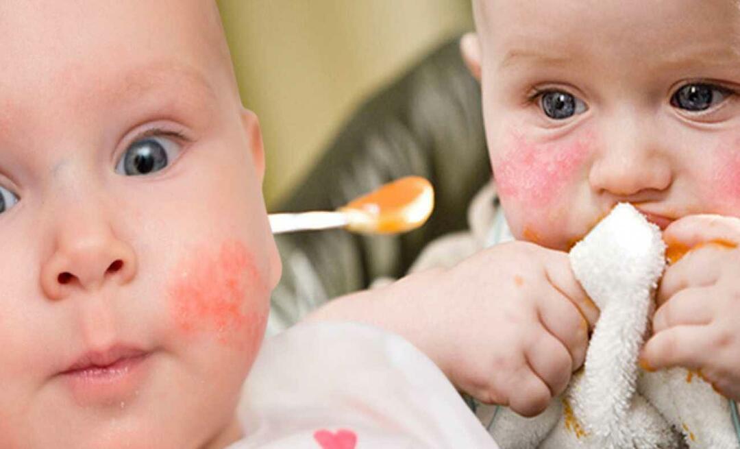 O que um bebê com alergia deve comer? Quais são os alimentos alternativos para bebês alérgicos?