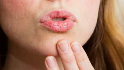 Como cuidar dos lábios em casa? Cuidado fácil para os lábios secos em 4 passos