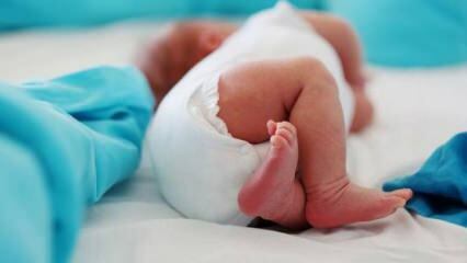 Os bebês devem fazer um ultrassom do quadril?
