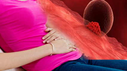 O que é sangramento de implantação durante a gravidez? Como distinguir entre sangramento de implantação e sangramento menstrual