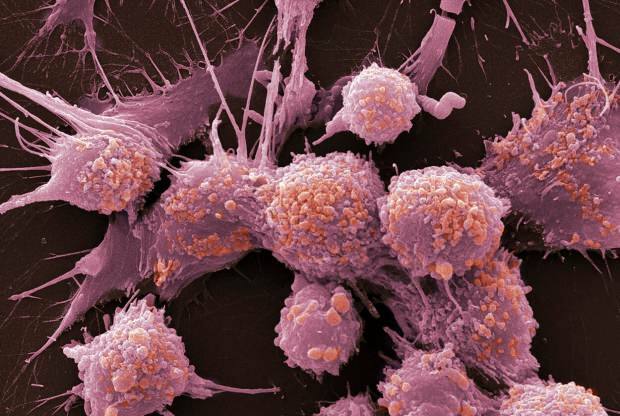 O que é câncer e quais são seus sintomas? Quantos tipos de câncer existem? Como o câncer é prevenido?