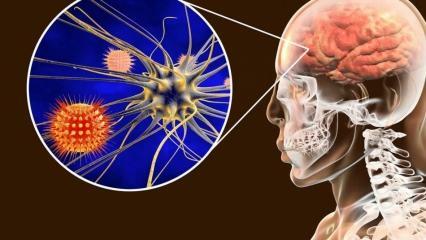 O que é meningite e quais são seus sintomas? Existe tratamento para meningite?