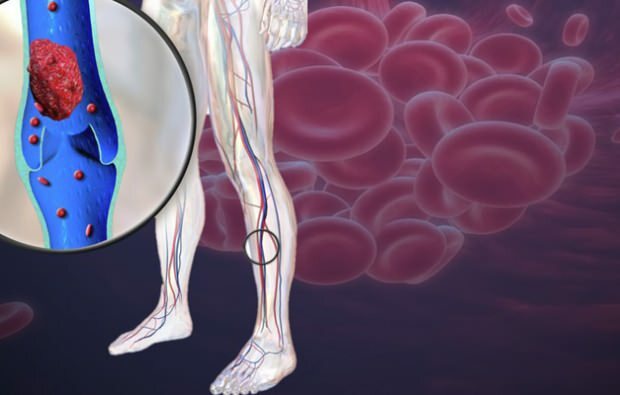 diminuição da circulação sanguínea nas veias das pernas causa dor